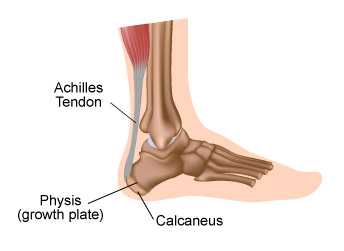 heelped-2 Drawing of child heel anatomy
